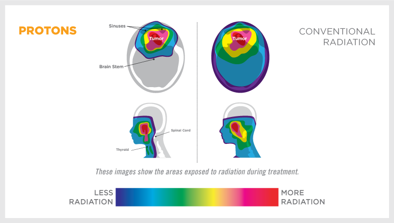 Chart Radiotherapy Head And Neck